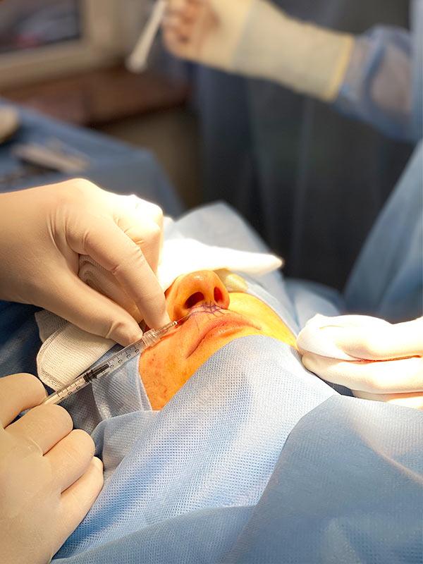 Пластический хирург Киев