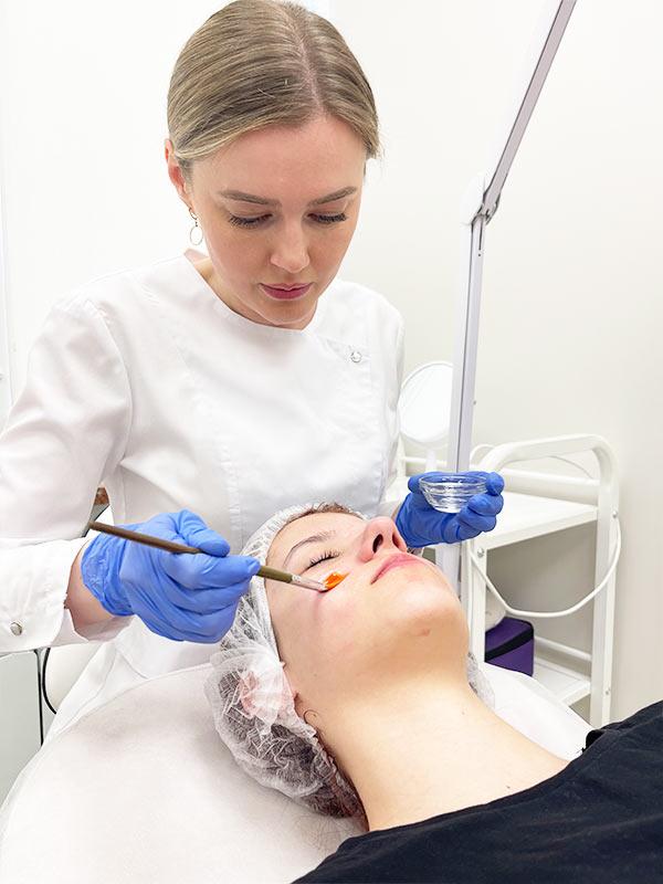 Пилинг лица - косметолог Киев
