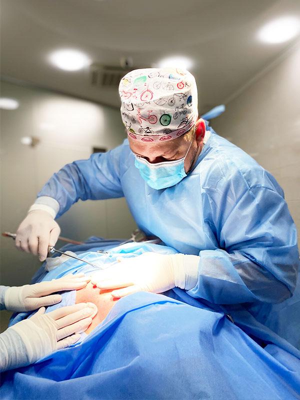 Липосакция холки Киев