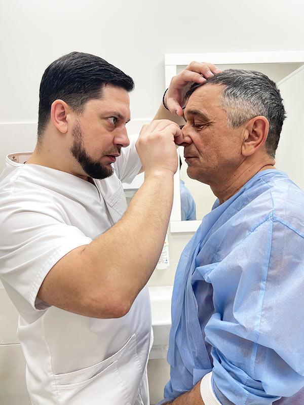 Блефаропластика - разметка перед операцией Киев Блефаропластика - разметка перед операцией Киев