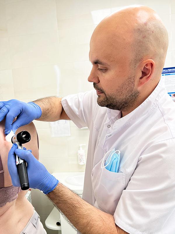 Консультация дерматолога с дерматоскопией Киев