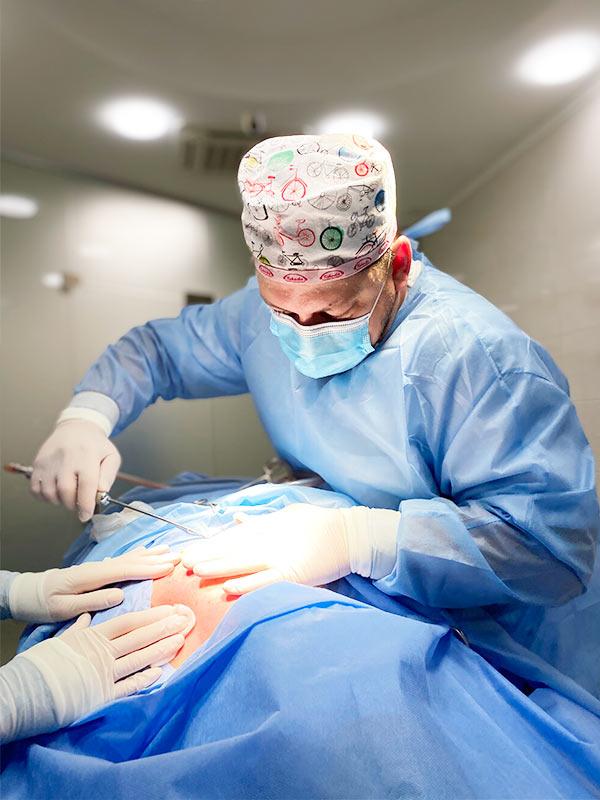 Липосакция тела Киев