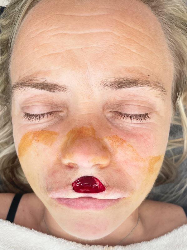 МОSH хирургия Киев МОSH хирургия Киев