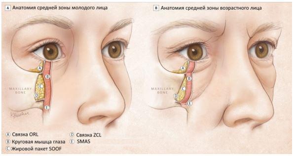 Грыжи верхнего и нижнего века