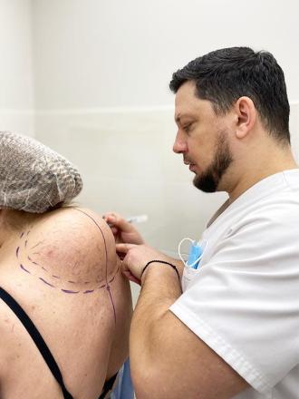 Консультація пластичного хірурга Київ Консультація пластичного хірурга Київ